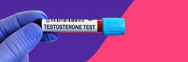 What are symptoms of high testosterone?