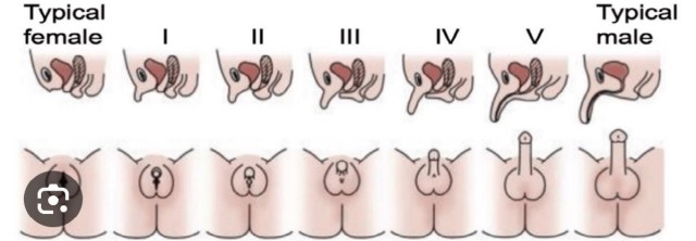 When youre intersex and you have both parts, where are they located?